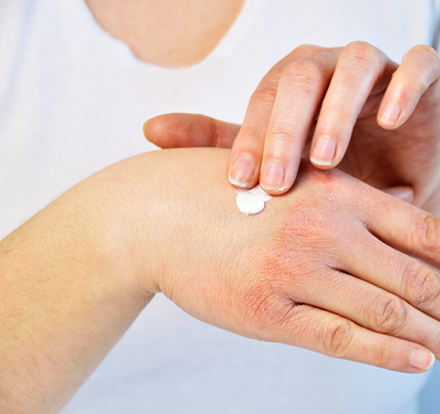 Learn more about Diomed Dry Skin, new moisturising emollient