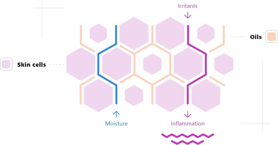 Diagram showing cracks between skin cells and oils, allowing moisture out and irritants in, causing inflammation